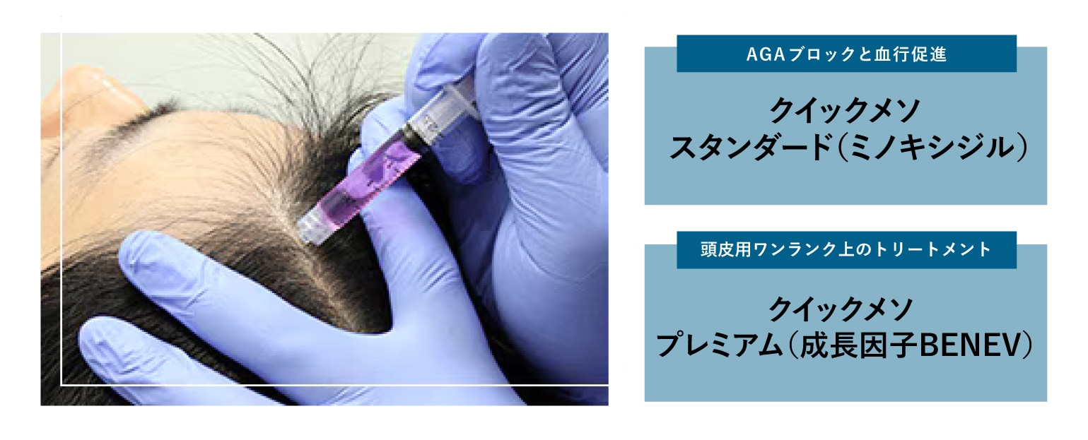 クイックメソで使用する薬剤