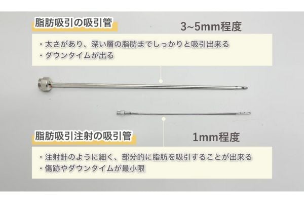 カニューレの太さの違い