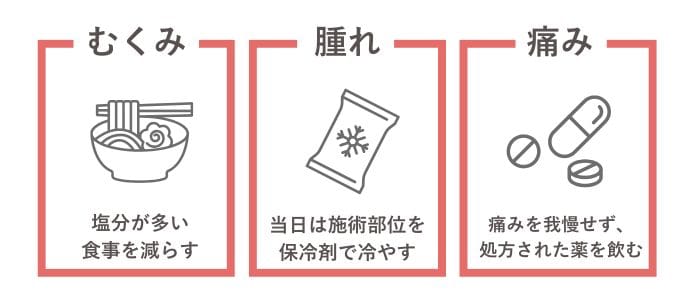 ダウンタイムを軽減するには