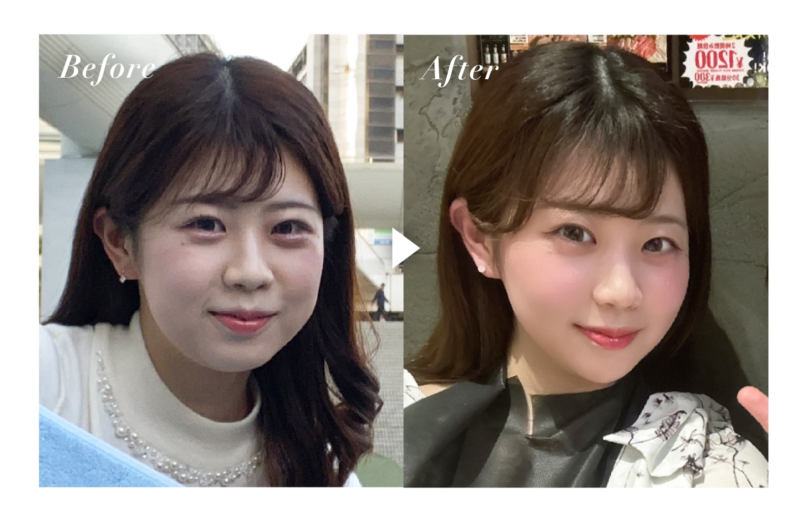 まるでアプリで加工したかのようなフェイスラインに⭐︎