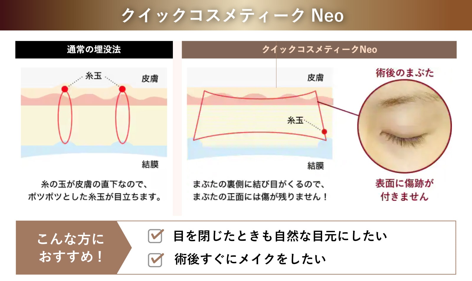 【長野院では五十嵐医師のみ執刀可能】クイックコスメティーク・ダブルneo