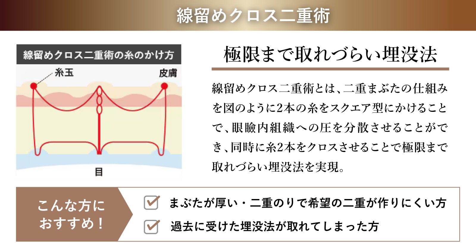 【耐久性の高い線留め】線留めクロス二重術