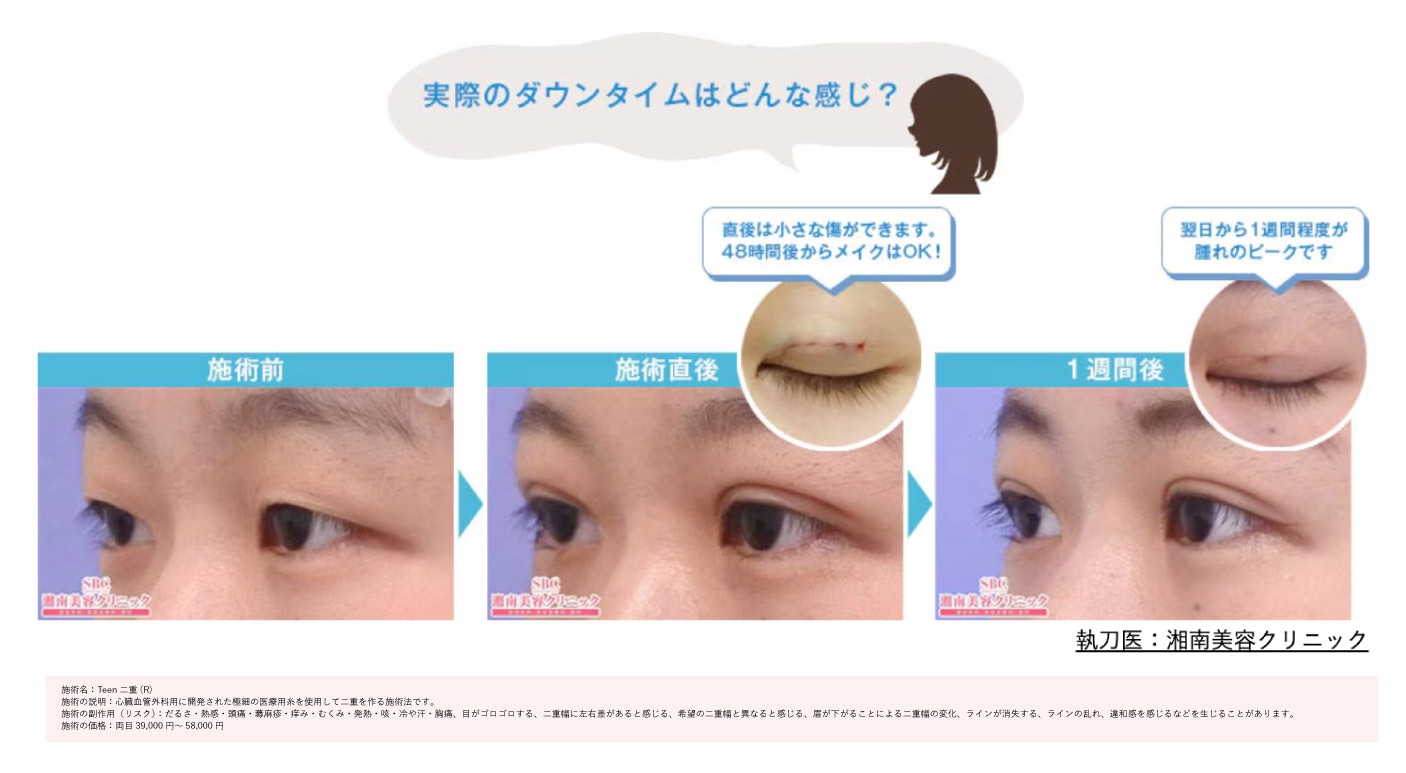 長期のお休み不要で、バレづらい!