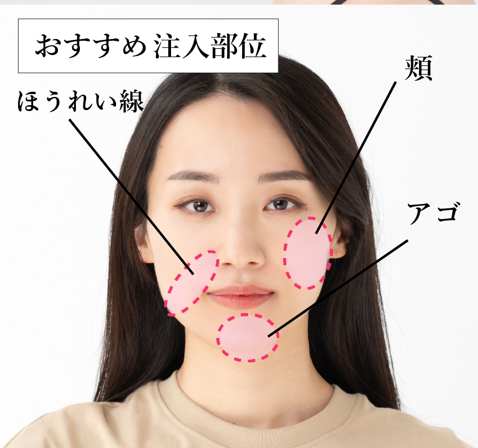 糸リフト× ヒアルロン酸