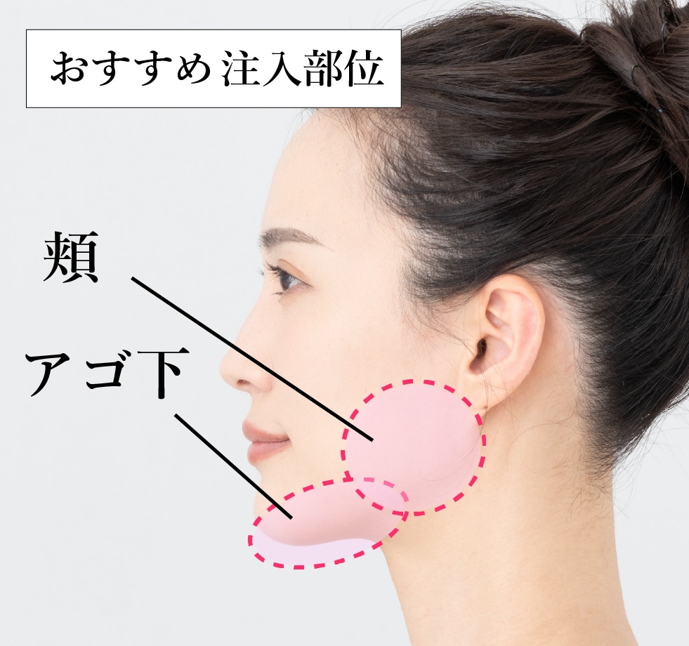 糸リフト× 脂肪吸引