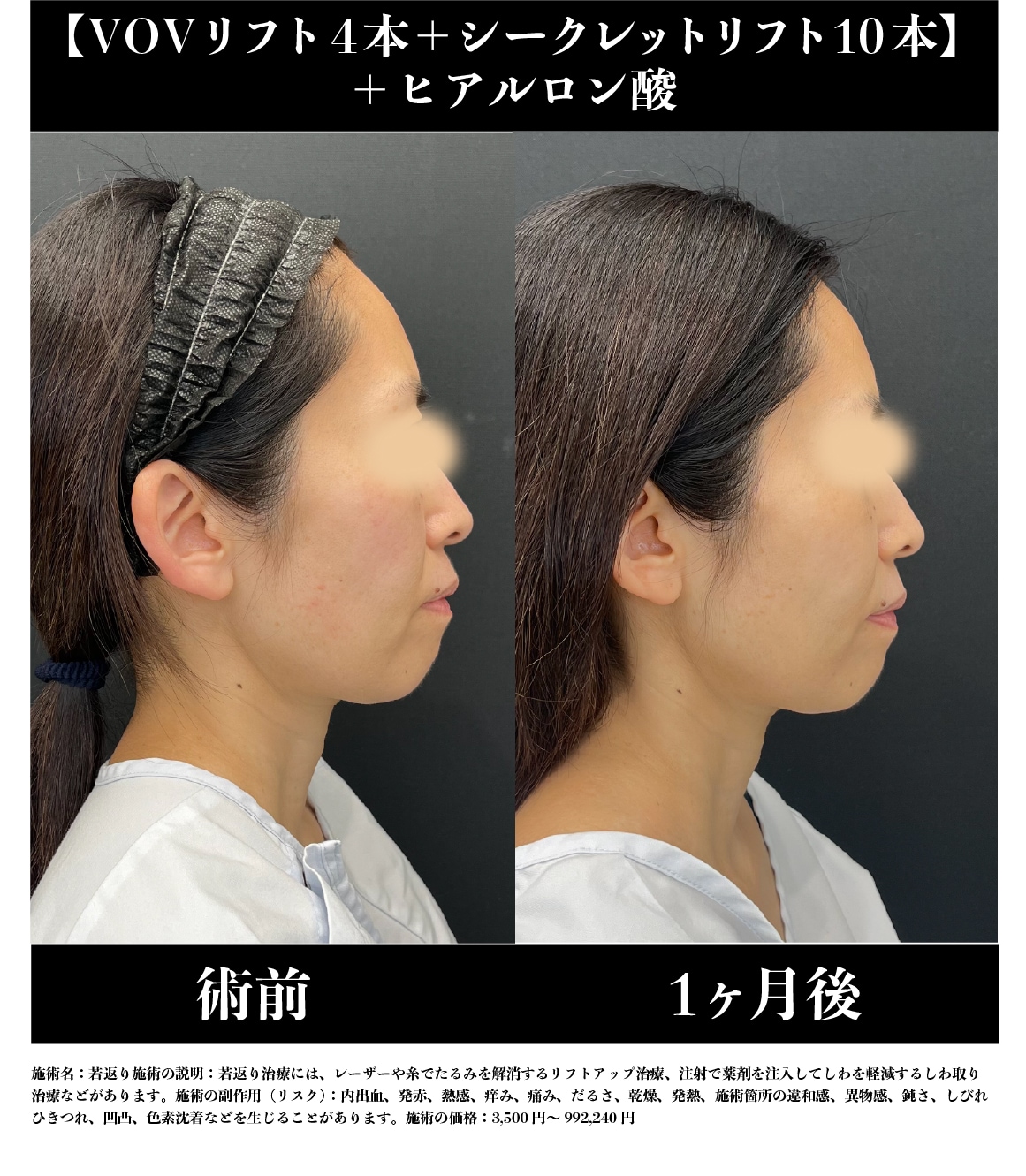 《40代》症例