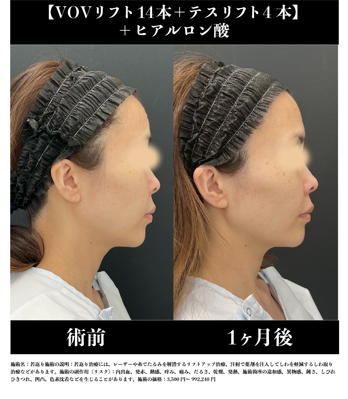 《40代》症例