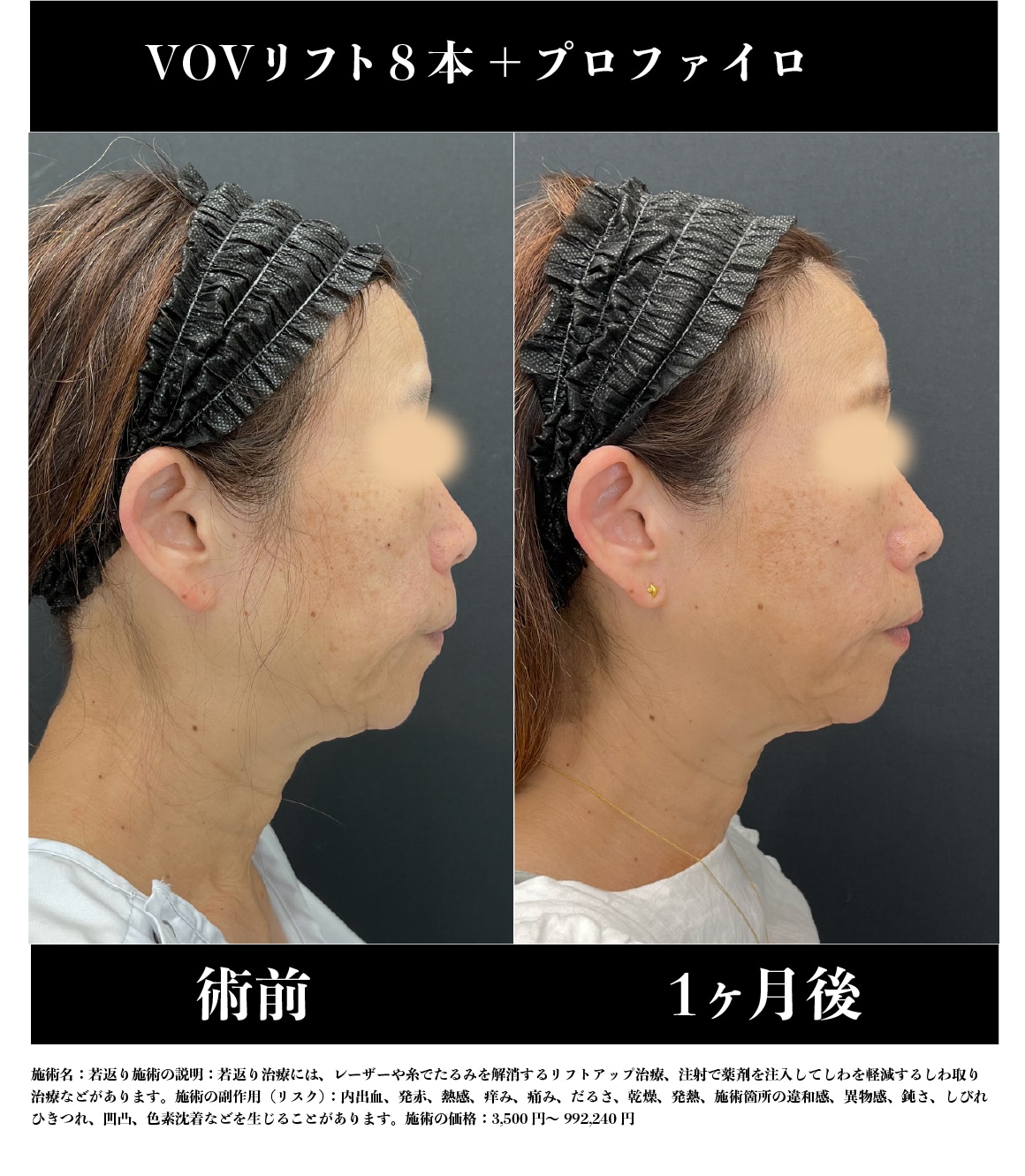 《60代》症例