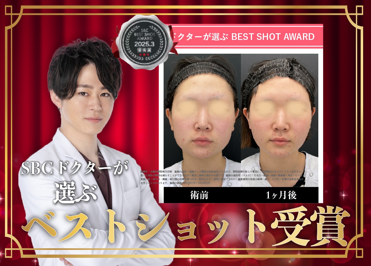 ベストショット受賞