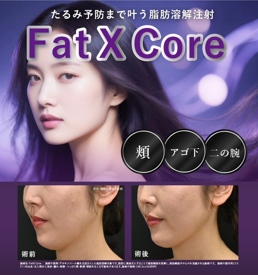 Fat X core
