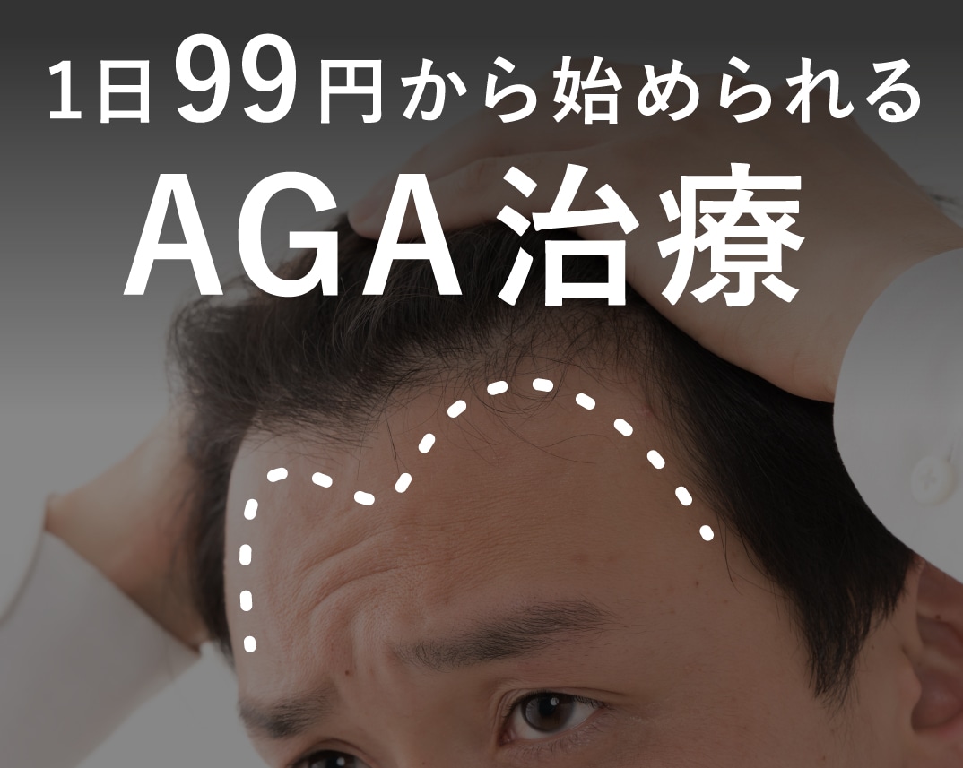 AGA治療が1日99円から始められる！【長野市でAGA治療なら湘南美容クリニック長野院】