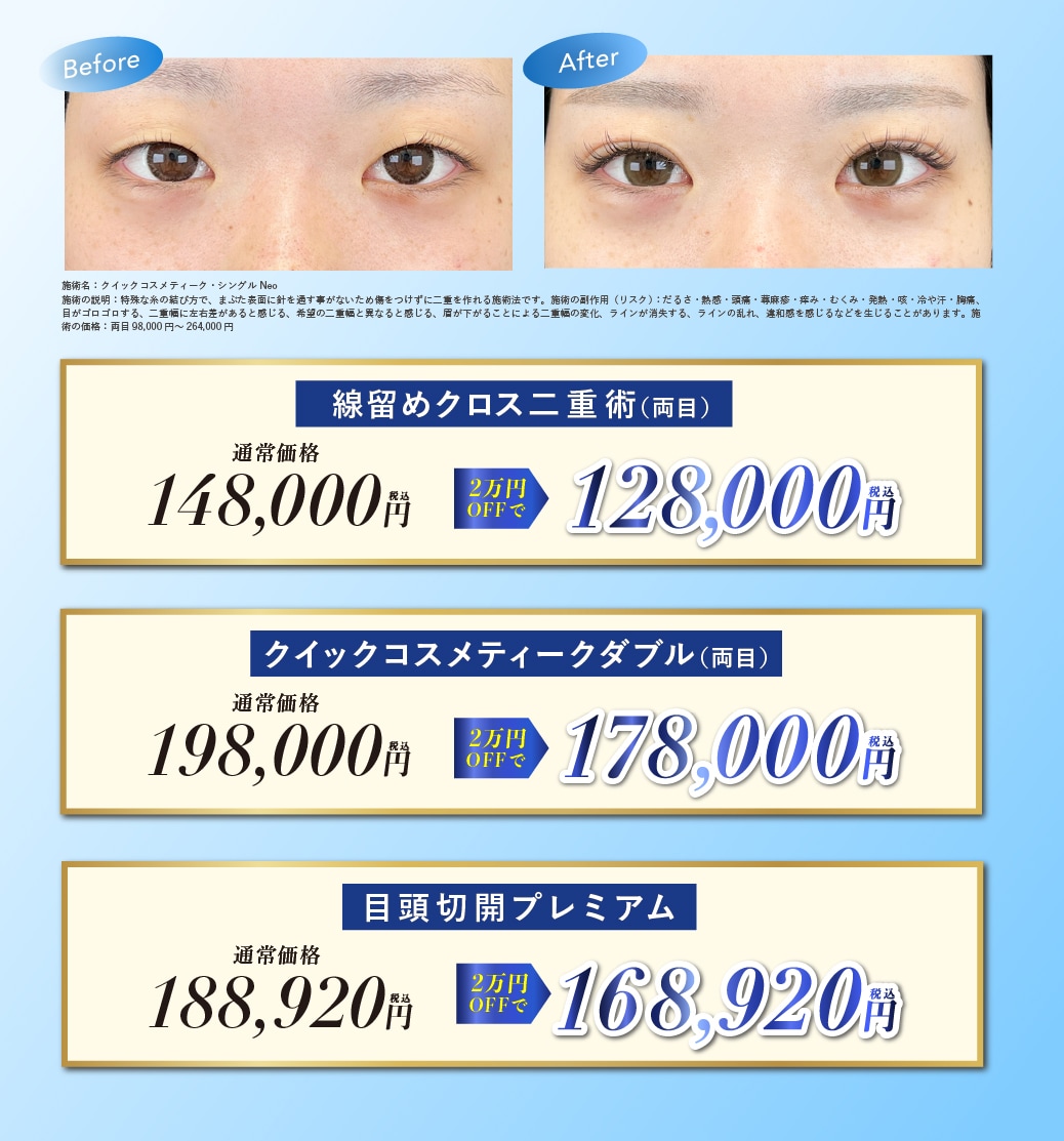 二重・目元整形