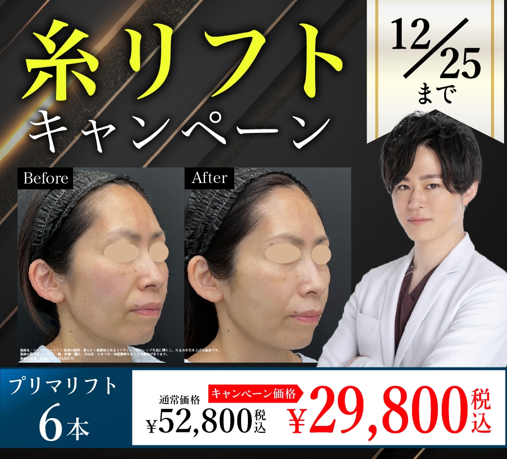 【長野で話題】糸リフトをするなら今！最大44%OFFキャンペーン実施中🎊