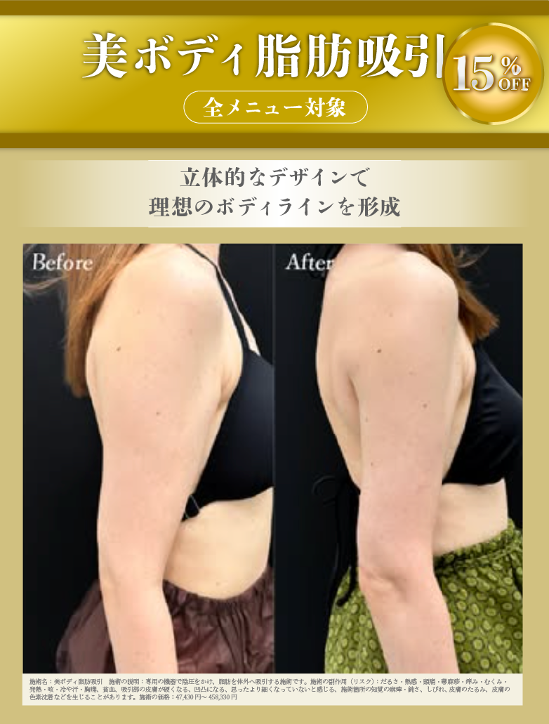 美ボディ脂肪吸引