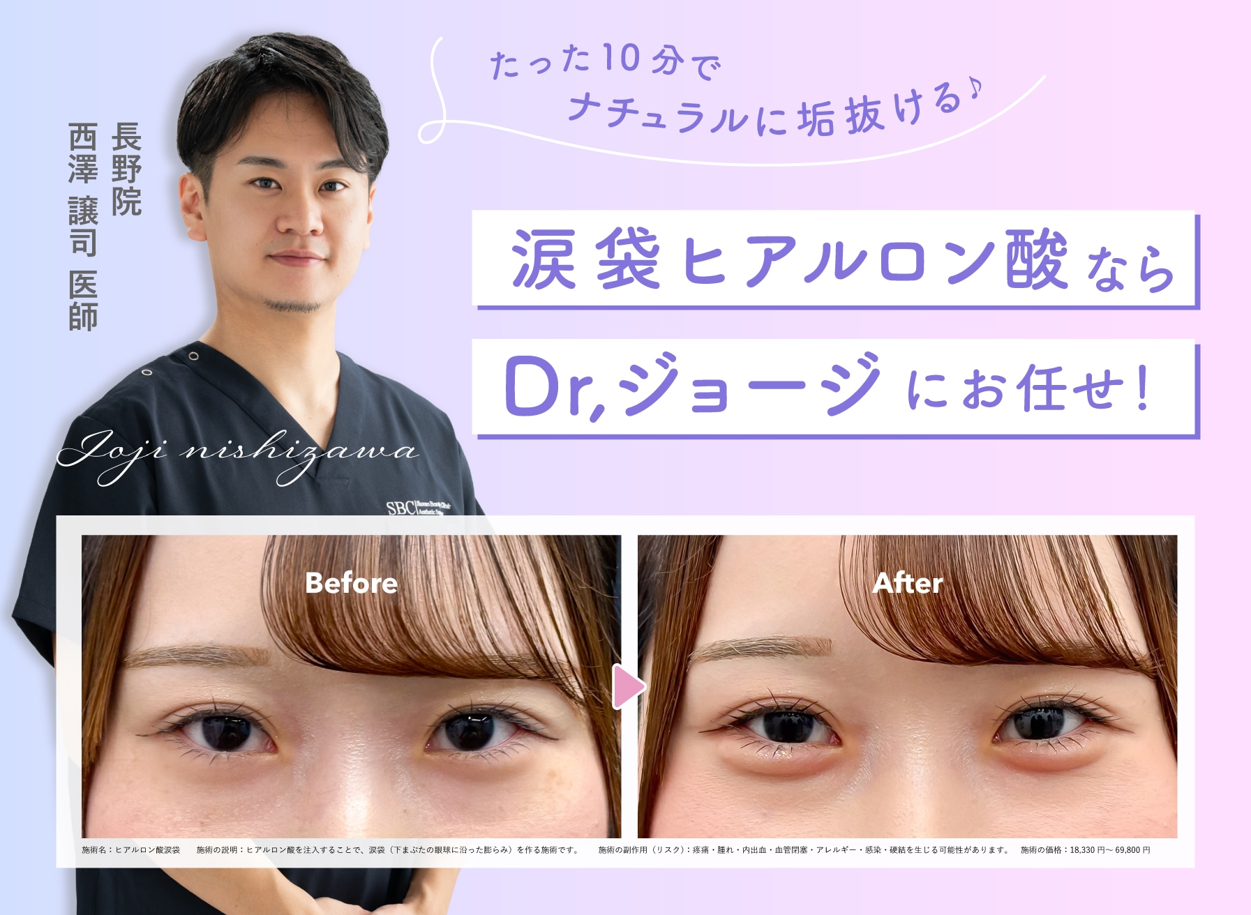 自然で可愛い涙袋を作るなら西澤医師にお任せ💉