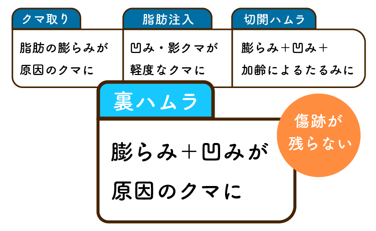 各クマ取りの特徴