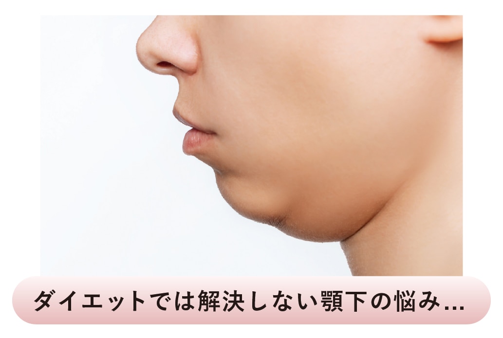 二重アゴやアゴ下のたるみ、諦めていませんか？