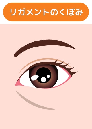 リガメントのくぼみ