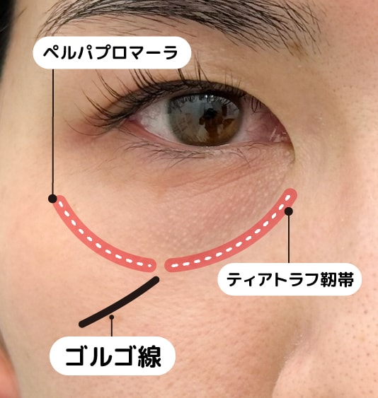 大きな違いは靭帯の剥離範囲！