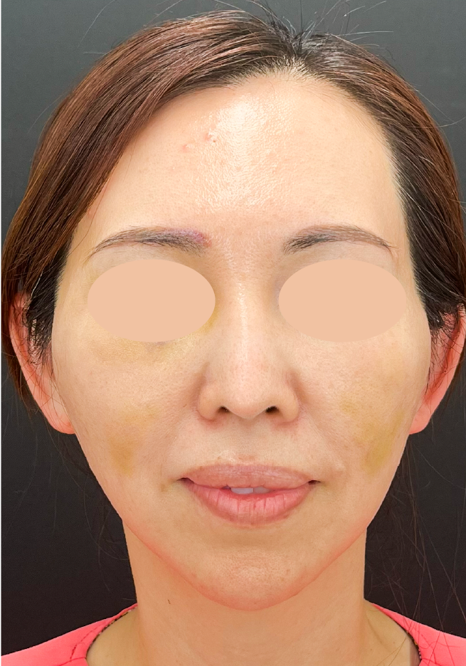 {施術名} {年代}  {性別} の術後の症例写真