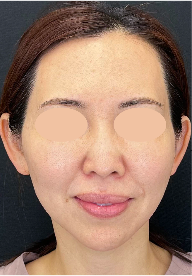 {施術名} {年代}  {性別} の術前の症例写真