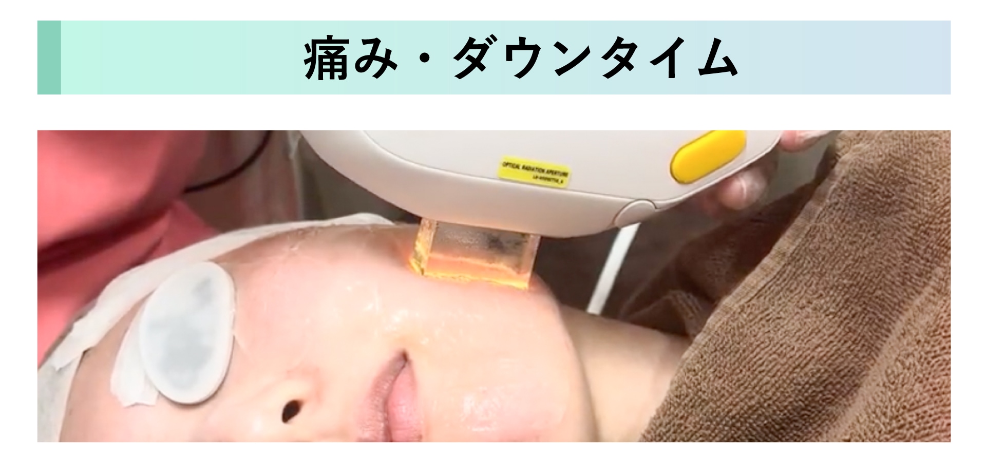 痛み・ダウンタイムについて