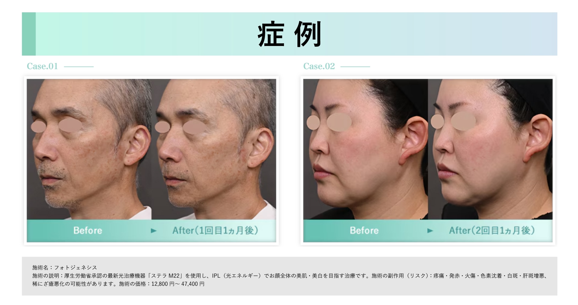 フォトジェネシス症例