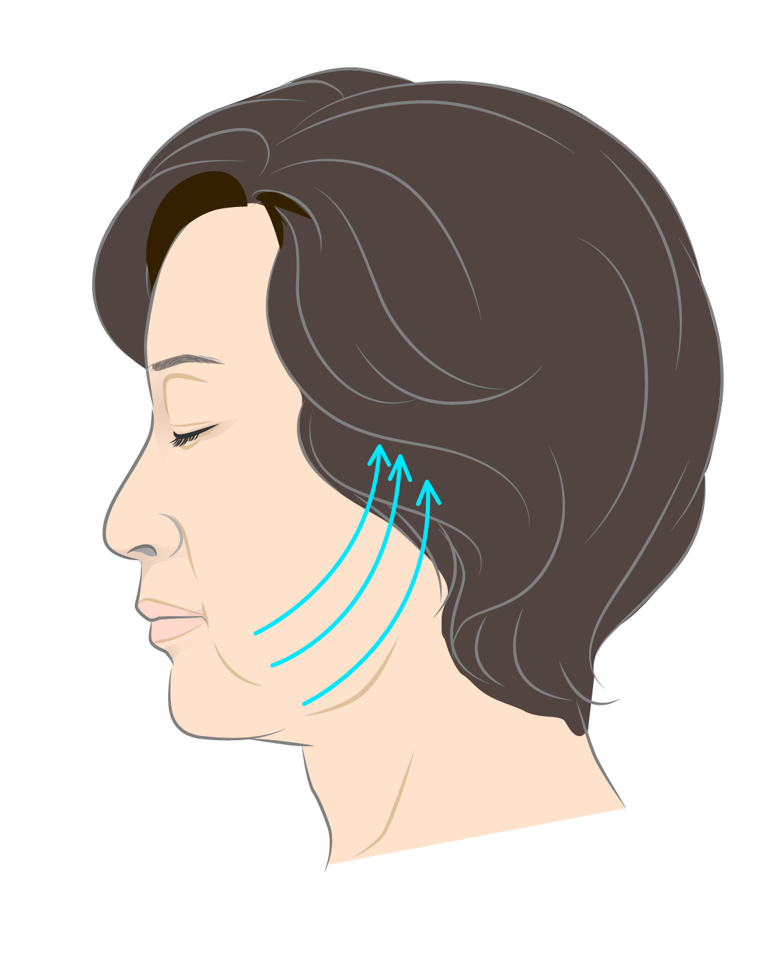 糸リフトとは？