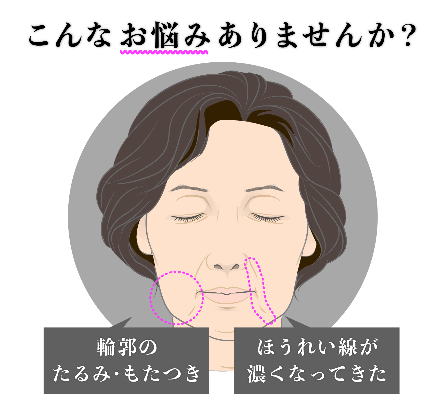 老けて見える原因は「輪郭の変化」