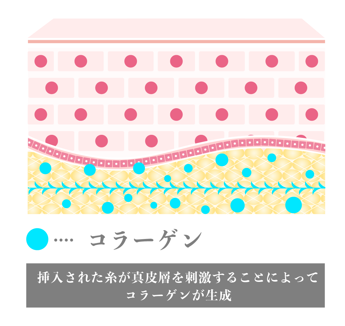 コラーゲンによる美肌効果も