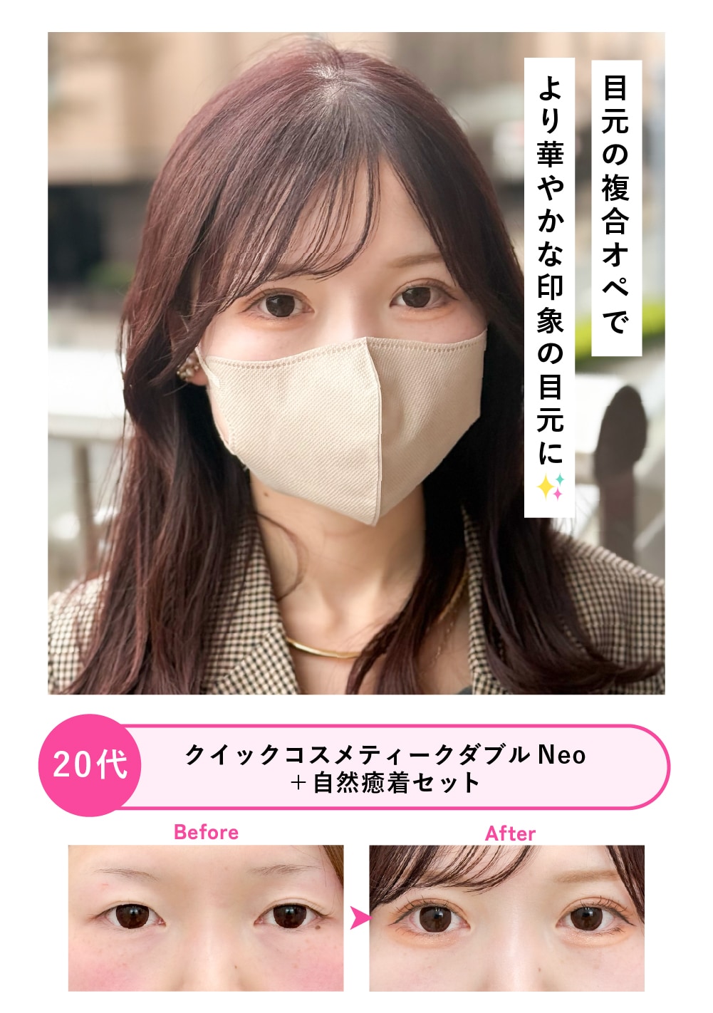 20代女性