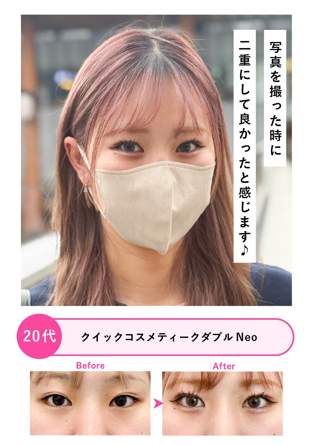 20代女性