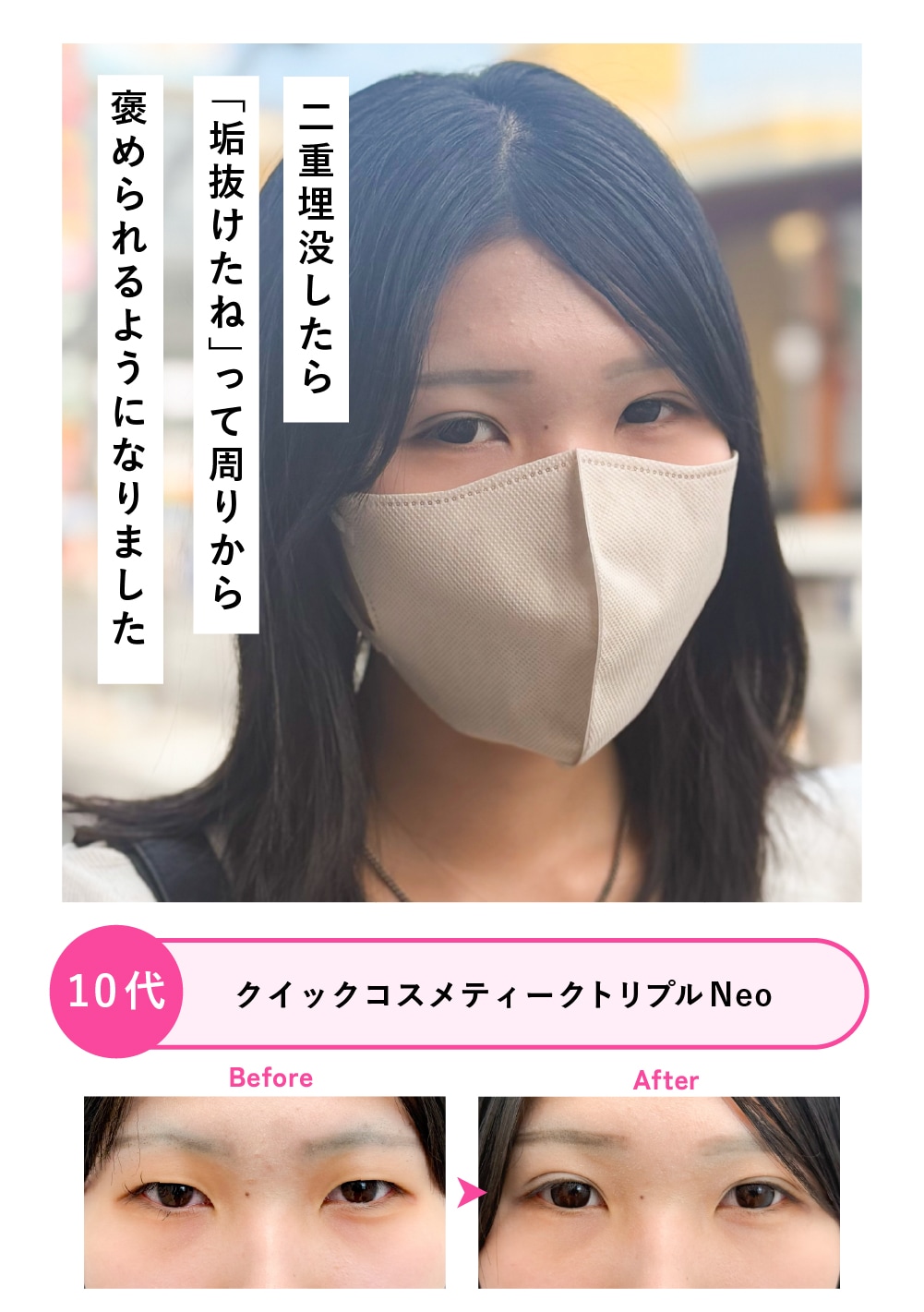 10代女性