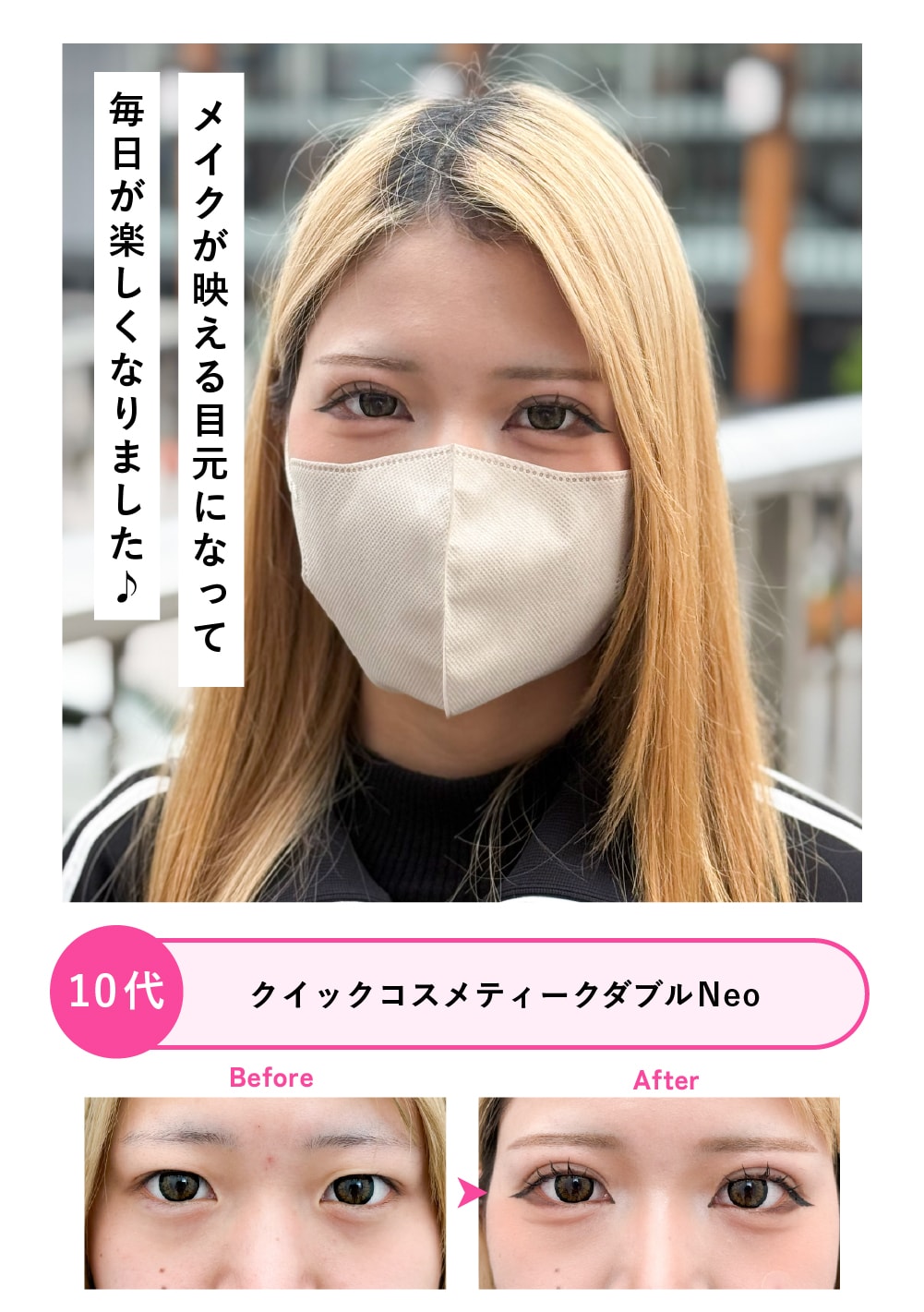 10代女性