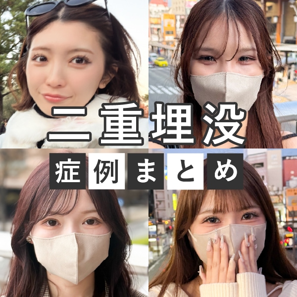 二重症例まとめ