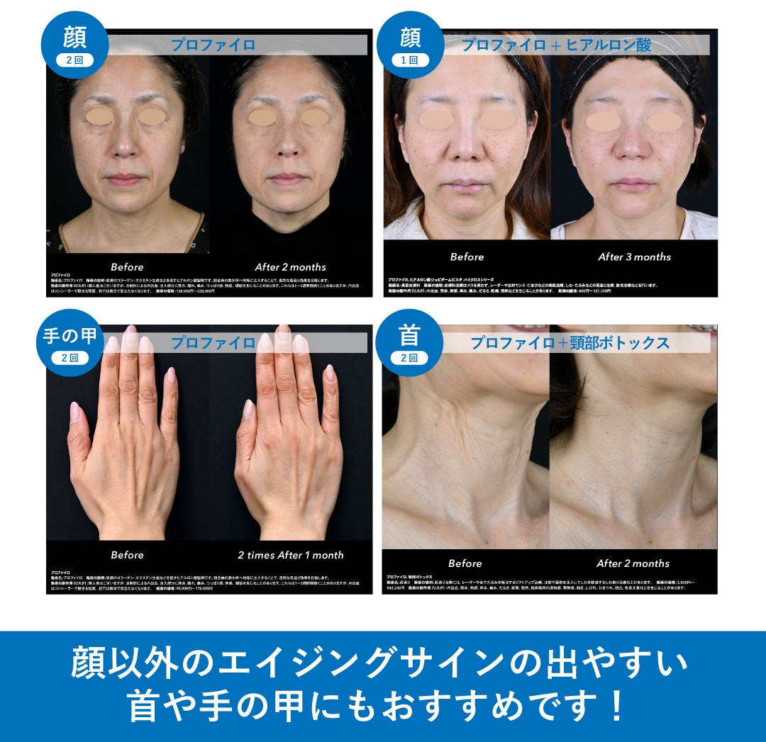 症例
