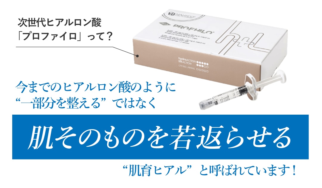 今知っておきたい「プロファイロ」の効果