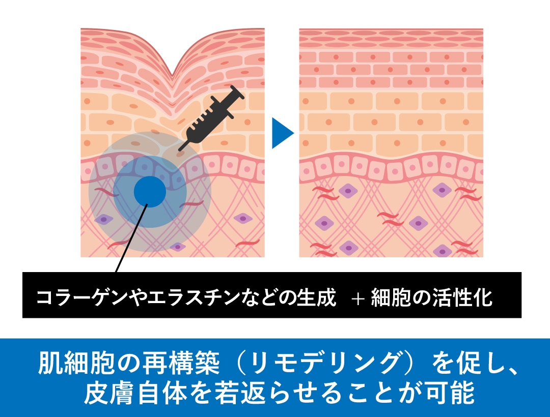 「プロファイロ」は肌細胞から若返る