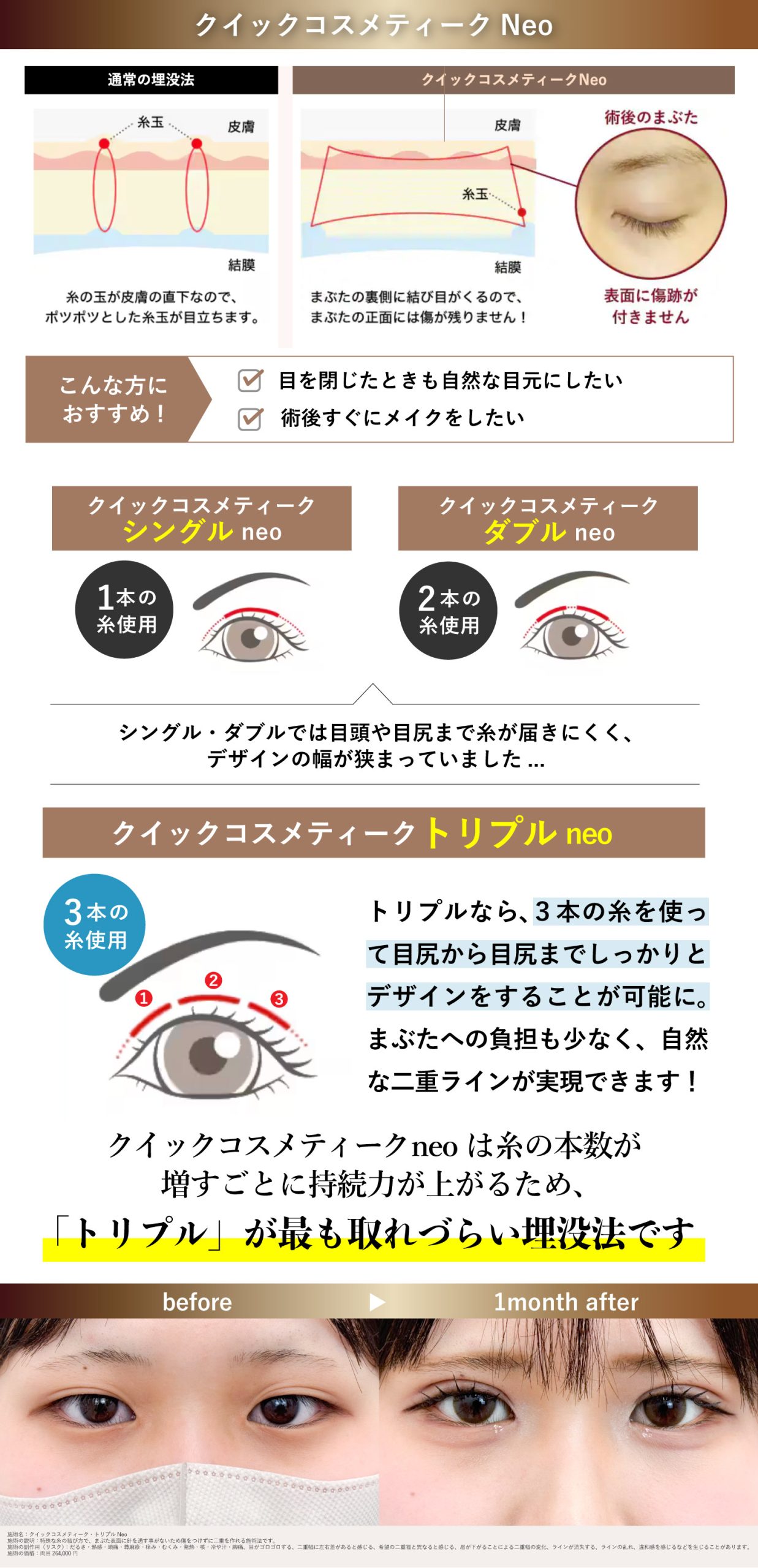 【長野院では五十嵐医師のみ執刀可能】クイックコスメティーク・ダブルneo