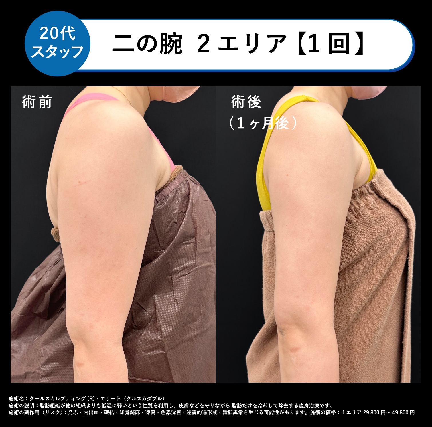 症例1 ▶︎30代スタッフ