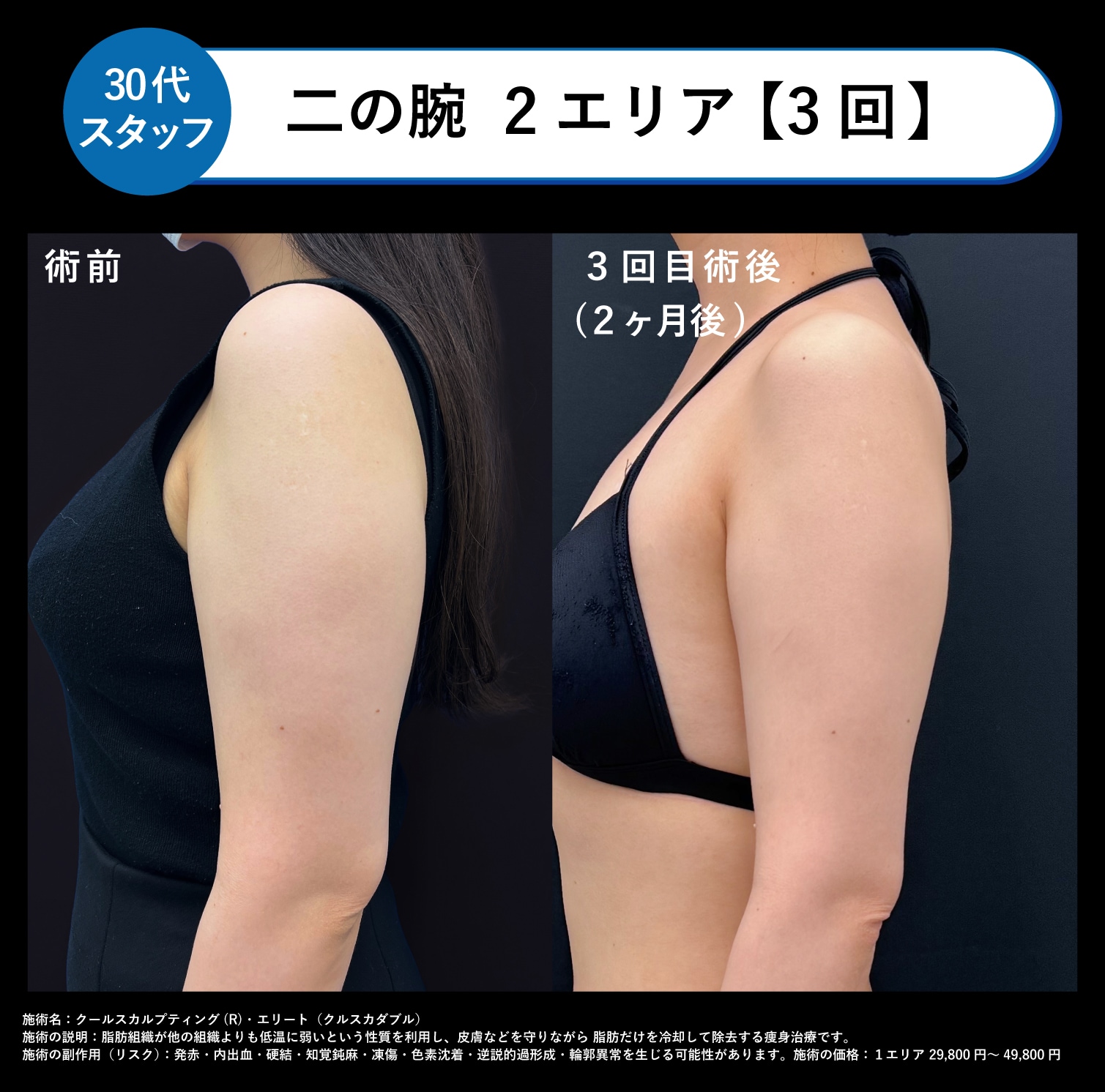 症例2▶︎30代スタッフ