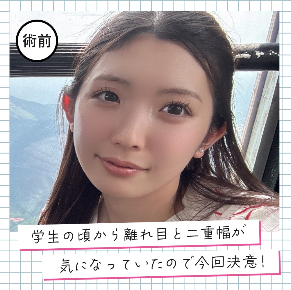 Q.施術を受けようと思ったきっかけを教えてください！