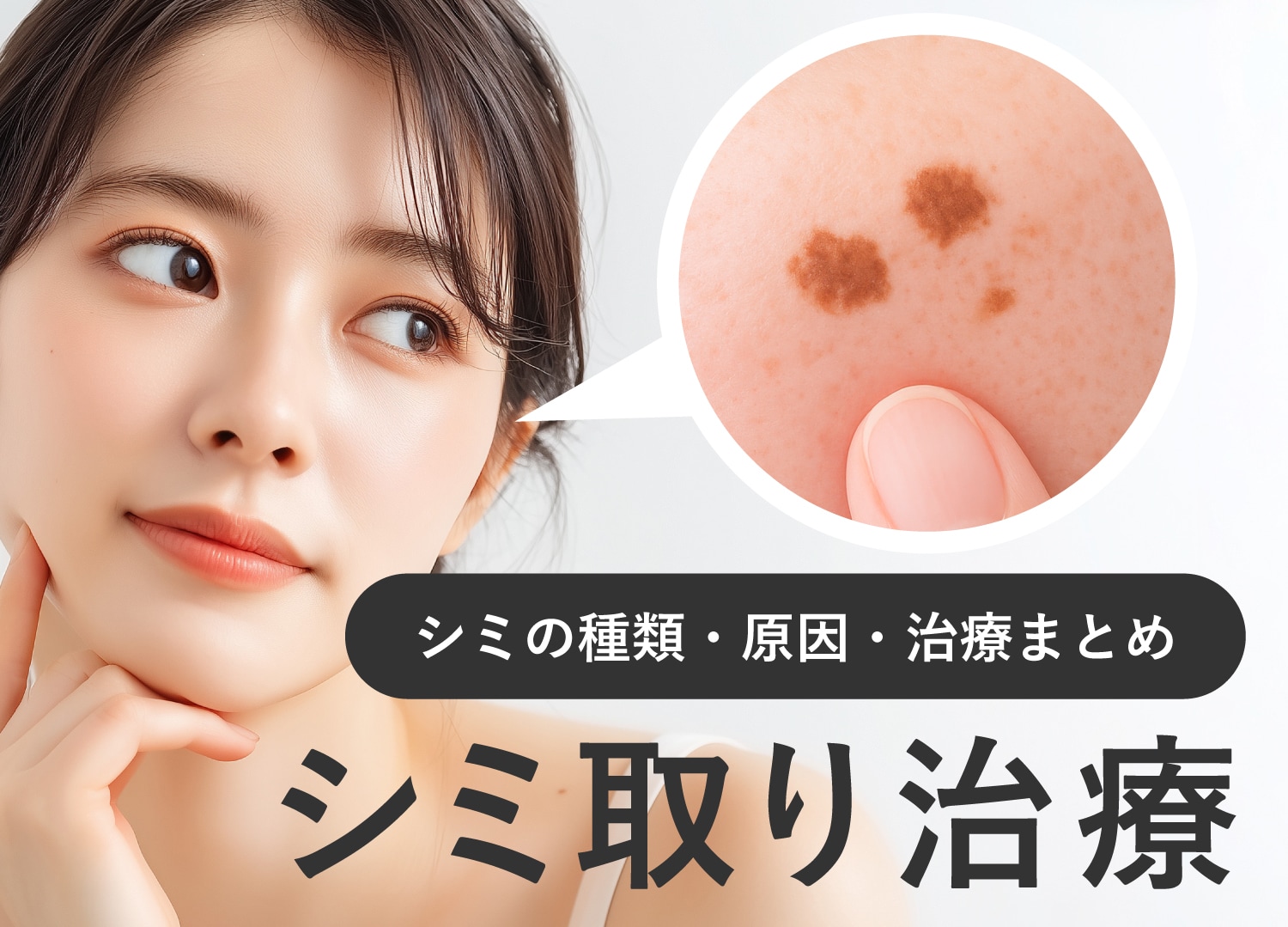 長野県・長野市【シミ種類別】レーザー治療おすすめ治療比較!シミ・肝斑・そばかすを悪化させずに治療する方法