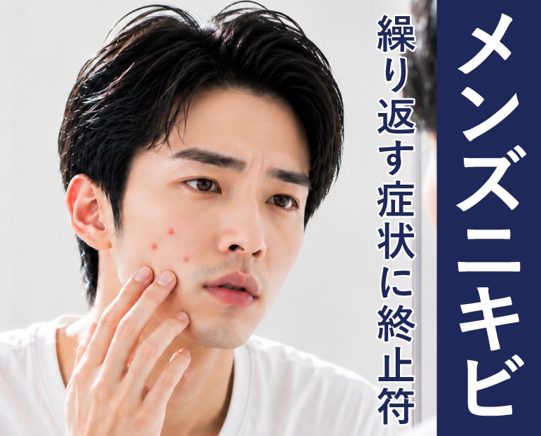 【医師監修】ニキビ治療繰り返す男性ニキビの根本原因とは？原因と理由を徹底解説