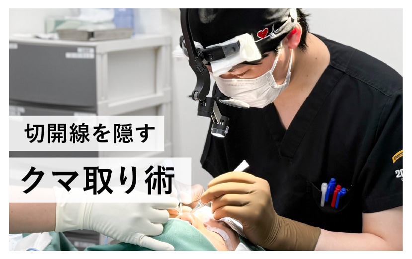 切開線を隠す「クマ取り術」