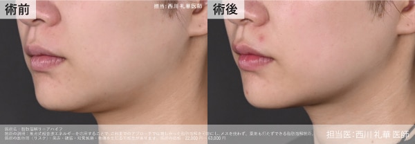 キャンペーン画像