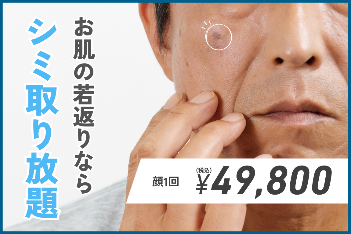 シミを取るだけで若返り!