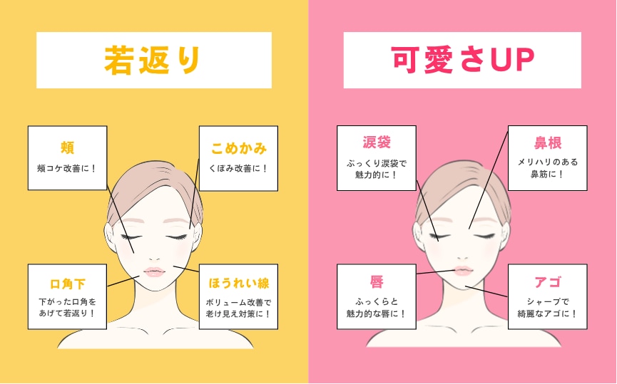 気になる部位はどこ？