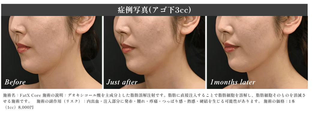 実際の効果をチェック!