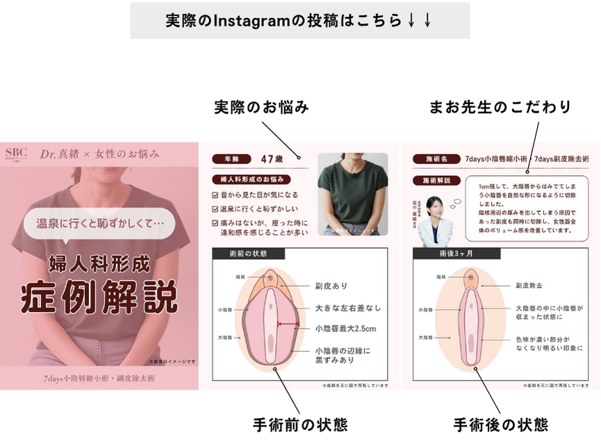 婦人科形成の症例